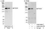 POGZ Polyclonal Antibody