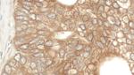 NEDD4L Polyclonal Antibody