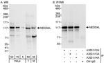 NEDD4L Antibody in Western Blot (WB)