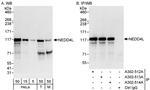 NEDD4L Polyclonal Antibody