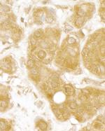 MERIT40 Polyclonal Antibody