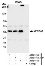 MERIT40 Antibody in Immunoprecipitation (IP)