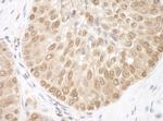 BRCC36 Polyclonal Antibody