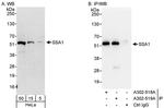 SSA1 Polyclonal Antibody