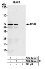 CBX2 Polyclonal Antibody