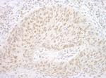 CBX7 Polyclonal Antibody