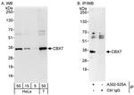 CBX7 Antibody in Western Blot (WB)