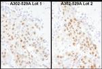 MBD3 Polyclonal Antibody