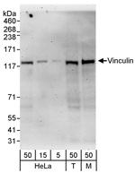 Vinculin Antibody in Western Blot (WB)
