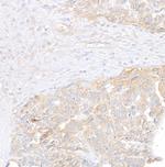 Vinculin Polyclonal Antibody