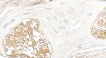Vinculin Antibody in Immunohistochemistry (Paraffin) (IHC (P))