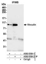 Vinculin Antibody in Immunoprecipitation (IP)