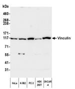 Vinculin Antibody in Western Blot (WB)