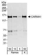 CARMA1 Polyclonal Antibody