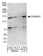CARMA1 Polyclonal Antibody
