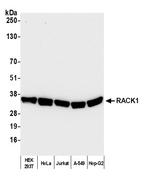 RACK1 Polyclonal Antibody
