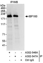 IBP160 Polyclonal Antibody