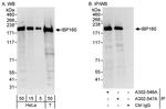 IBP160 Antibody in Western Blot (WB)