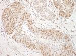 TFIP11 Polyclonal Antibody
