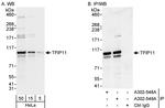 TFIP11 Polyclonal Antibody