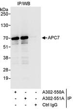 APC7 Antibody in Immunoprecipitation (IP)