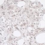 ADRM1 Polyclonal Antibody