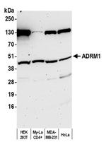 ADRM1 Antibody in Western Blot (WB)