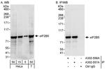 eIF2B5 Antibody in Western Blot (WB)