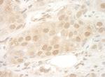eIF2B5 Antibody in Immunohistochemistry (Paraffin) (IHC (P))
