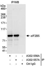 eIF2B5 Antibody in Immunoprecipitation (IP)