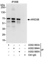 ARID3B Polyclonal Antibody