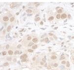 ARID3B Polyclonal Antibody