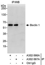 Beclin 1 Antibody in Immunoprecipitation (IP)