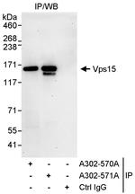 Vps15 Polyclonal Antibody