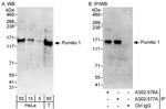 Pumilio 1 Polyclonal Antibody