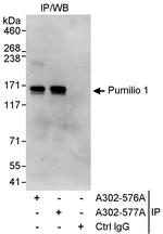 Pumilio 1 Polyclonal Antibody
