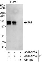 SA1 Antibody in Immunoprecipitation (IP)
