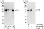 SA2 Antibody in Western Blot (WB)