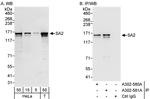 SA2 Antibody in Western Blot (WB)