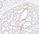 BRD2 Polyclonal Antibody