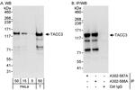 TACC3 Polyclonal Antibody