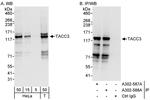 TACC3 Polyclonal Antibody