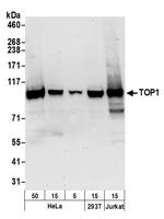 TOP1 Polyclonal Antibody