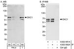 DKC1 Polyclonal Antibody