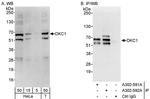 DKC1 Polyclonal Antibody