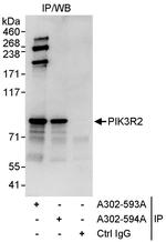 PIK3R2 Polyclonal Antibody