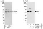 Dcp2 Polyclonal Antibody