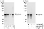 Cortactin Polyclonal Antibody
