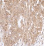 MK5 Polyclonal Antibody