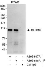 CLOCK Antibody in Immunoprecipitation (IP)